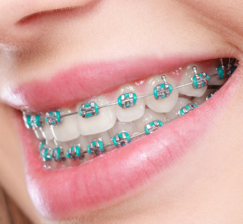 Orthodontics